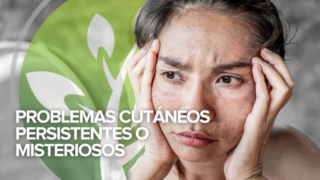 Martes de testimonios: Problemas cutáneos persistentes o misteriosos