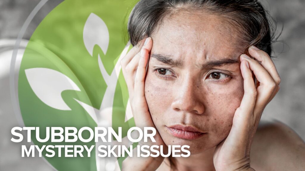 Testimonial Tuesday: Stubborn or Mystery Skin Issues